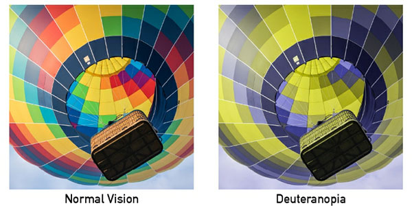 Types and levels of color blindness